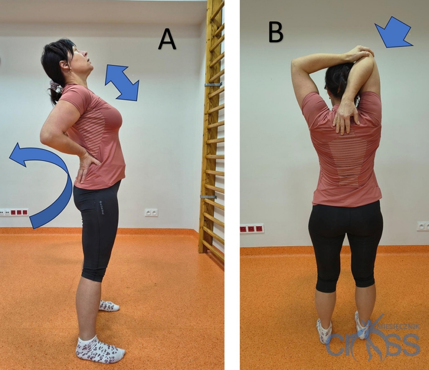 kobieta odchyla plecy do tyłu a także na drugim zdjęciu łapie się ręką za łopatkę